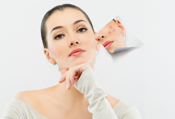 Acne Pimples 9 ACNE/PIMPLES