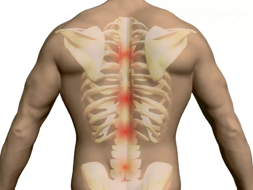 Spine Treatment