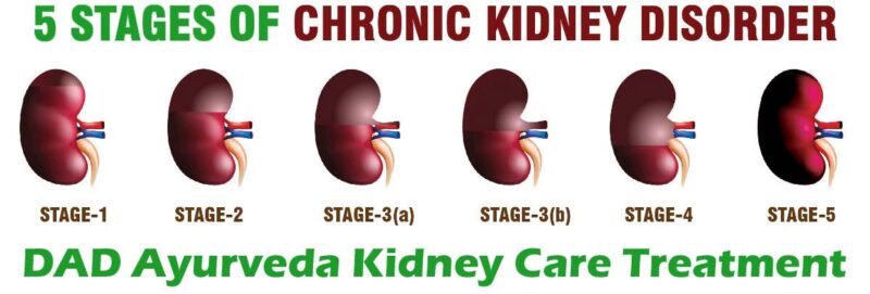 Chronic Kidney Disease Treatment Pack 9 Untitled 2 copy 1 - DAD Ayurveda