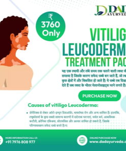 Vitiligo Leucoderma Treatment Pack