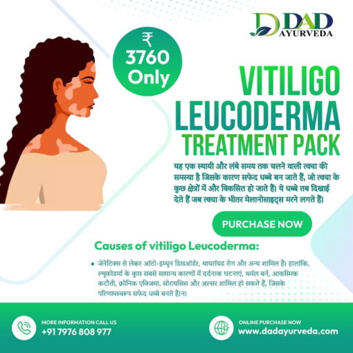 Vitiligo Leucoderma Treatment Pack