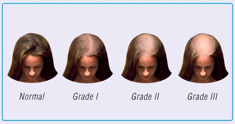 Womens Hair Loss Treatment - DAD Ayurveda