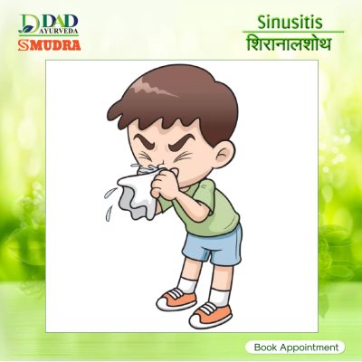 Cupping Therapy 3 Sinusitis