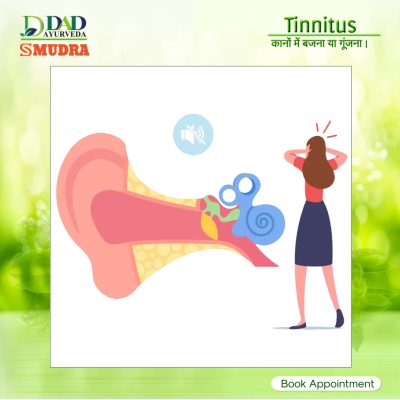 Tinnitus Treatment In Ayurveda 3 Tinnitus