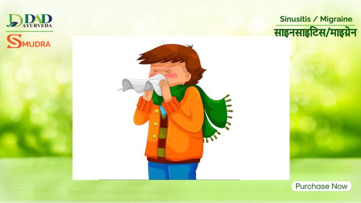 Understanding the Link Between Sinusitis and Migraine