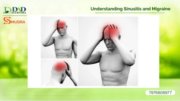 Understanding Sinusitis and Migraine How DAD Ayurveda Offers the Best Treatment