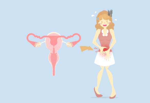 Dysmenorrhea 9 Gonorrhea