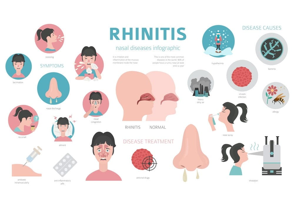 The Ultimate DAD Ayurveda Treatment for Sinusitis Migraine: Say Goodbye to Pain