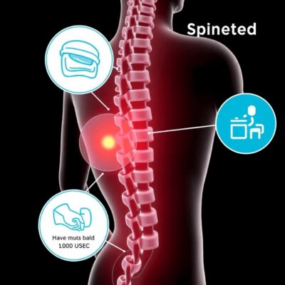 Back Pain Caused by a Pinched Nerve or Degenerated Disc? 2 Back Pain Caused by a Pinched Nerve 4 - DAD Ayurveda