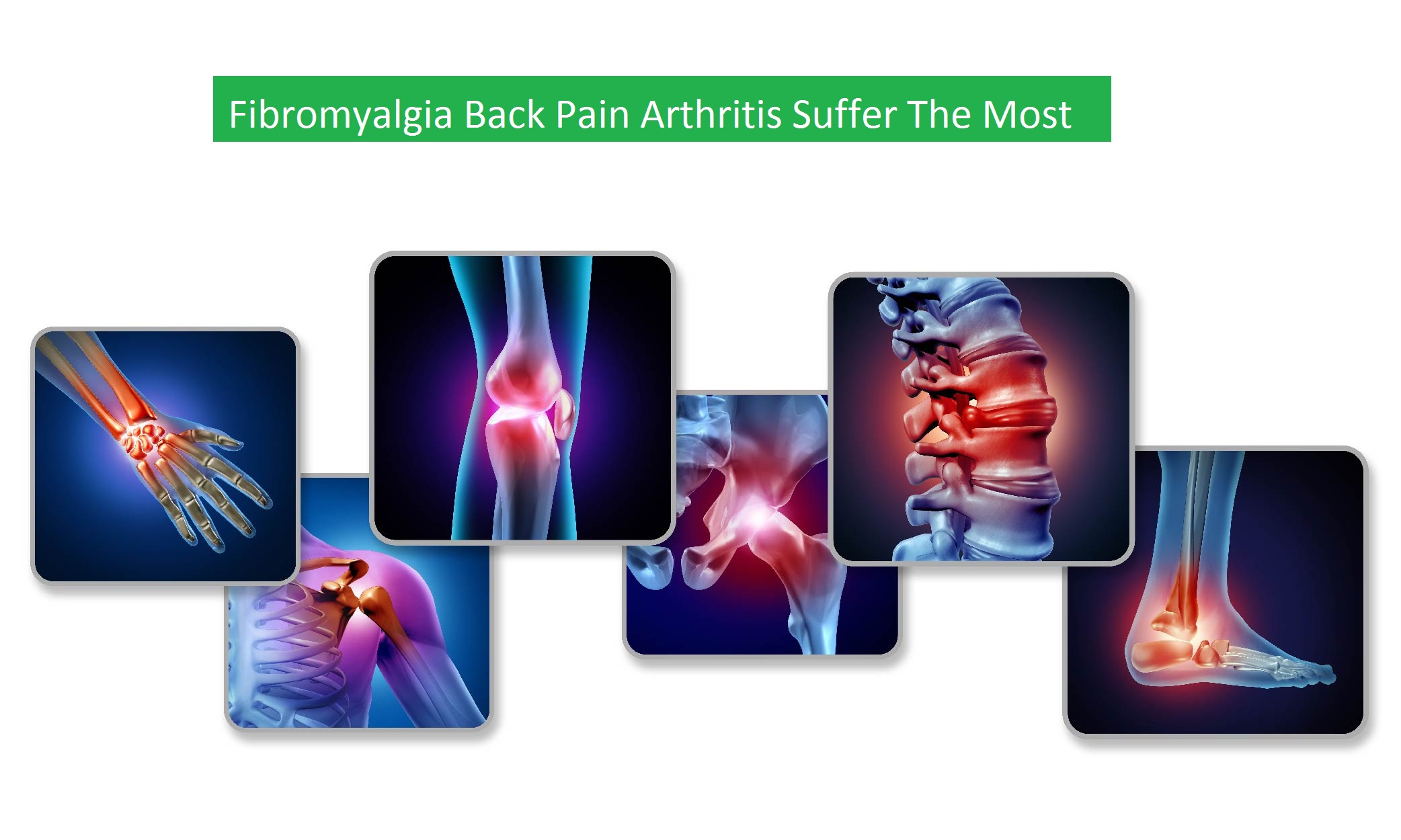 Fibromyalgia Back Pain Arthritis Suffer The Most