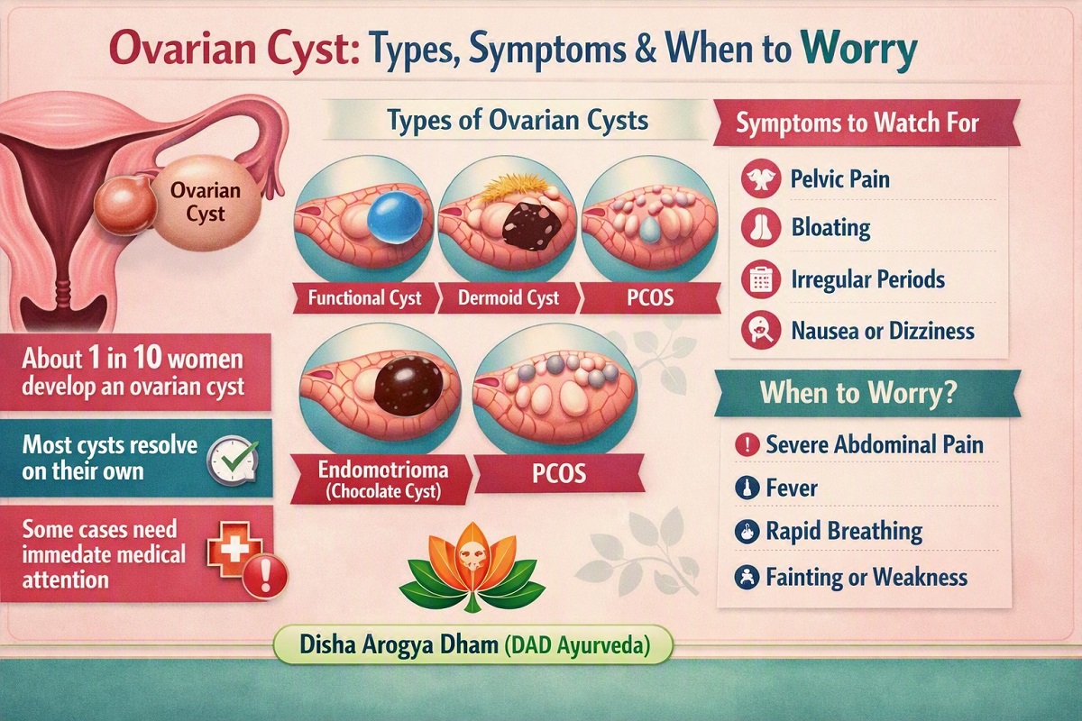 Ovarian Cyst Types, Symptoms, and When to Worry